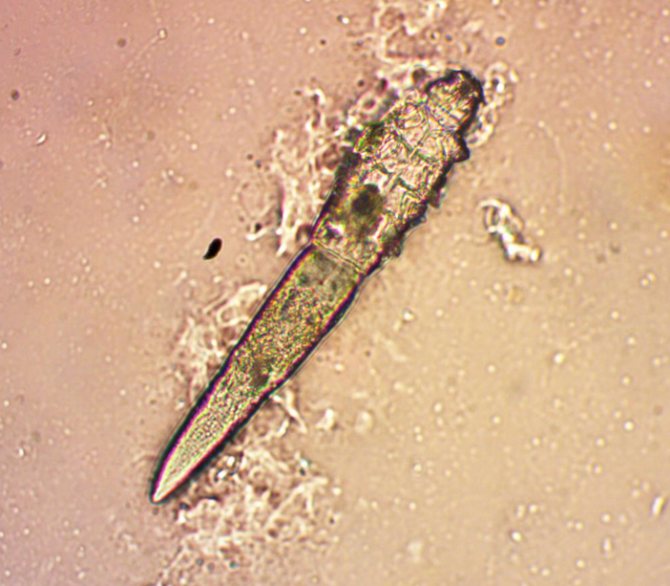 Клещ Demоdex canis под микроскопом при увеличении в 400 раз