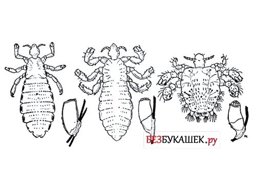 Виды вшей: какие бывают вши у человека (фото)